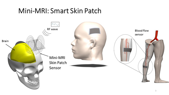 The smart skin patch could measure multiple parameters, including blood flow and intercranial pressure.