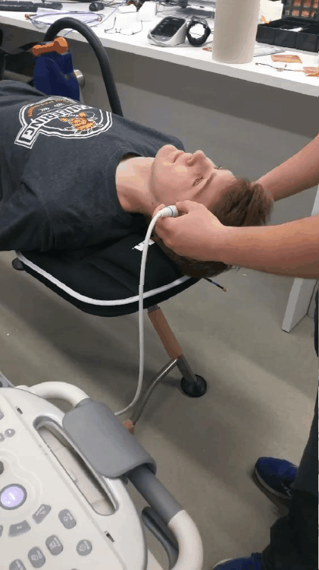 Animated GIF of a Transcranial Doppler Ultrasound being demonstrated on a student. 