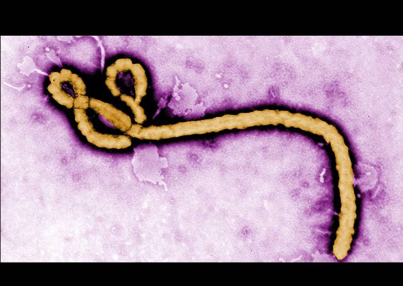 Ebola virus photo Ebola virus photo