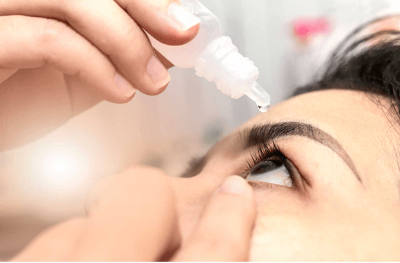 Woman putting in eye drops Woman holding eye dropper abover her eye about to put drops in